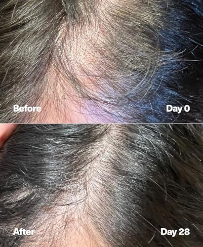 PowerCycle Exosome Scalp Serum – Exosomes for Hair Regrowth, NX35 Growth Serum, Hair Thickening Treatment for Women and Men, Lightweight Leave-In Formula, 60 mL