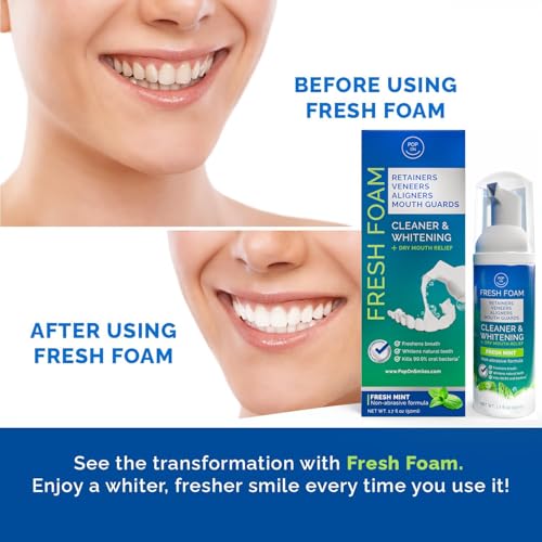 Retainer Cleaner Foam for Invisalign, Aligner Cleaner Whitening Foam for Mouth Guard Night Guard Veneers, Whitens Teeth, Freshens & Fights Bad Breath, 3% Hydrogen Peroxide, Mint - 50ml