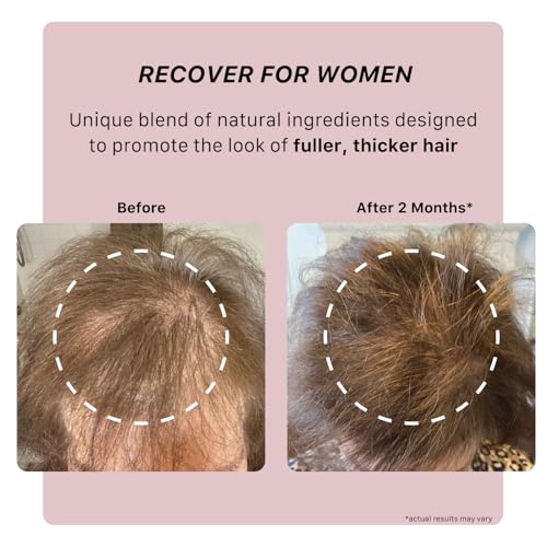 ACTIIV Recover Thickening Shampoo Treatment For Women | Supports the Appearance of Fuller, Healthier-Looking Hair, Supports Scalp Health, Plant-Based, Color-Safe, Vegan, All Hair Types