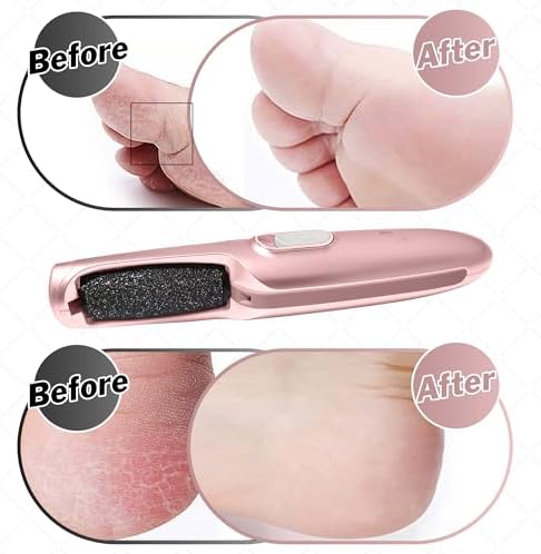 Powerful Electric Callus Remover Wand – Rechargeable Foot File, Grinder & Scrubber - Removes Dead, Hard Skin & Calluses – Best Pedicure Tool for Soft, Smooth Feet for Men & Women (Rose Gold)