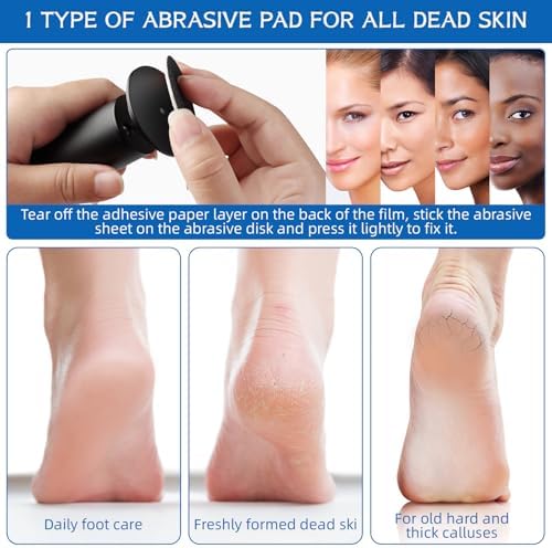 Dermave Electric Foot Callus Remover, Electric Callus Remover Feet, Callus Remover for Feet - Foot Filer with 60pcs Sanding Discs for Dead Cracked Skin, Men/Women (Black)