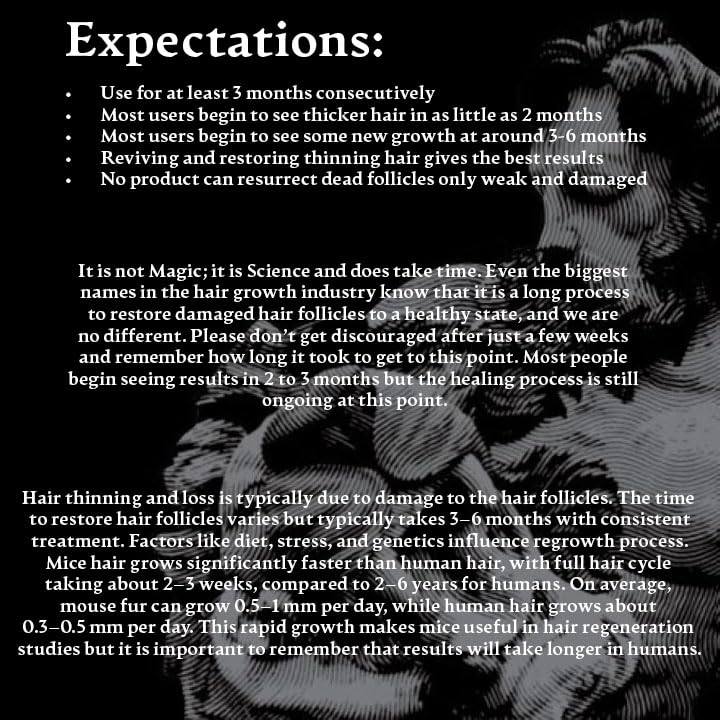 Samson's Hair Regrowth Serum (Deoxyribose (2dDr) 1% formula) (30mL)