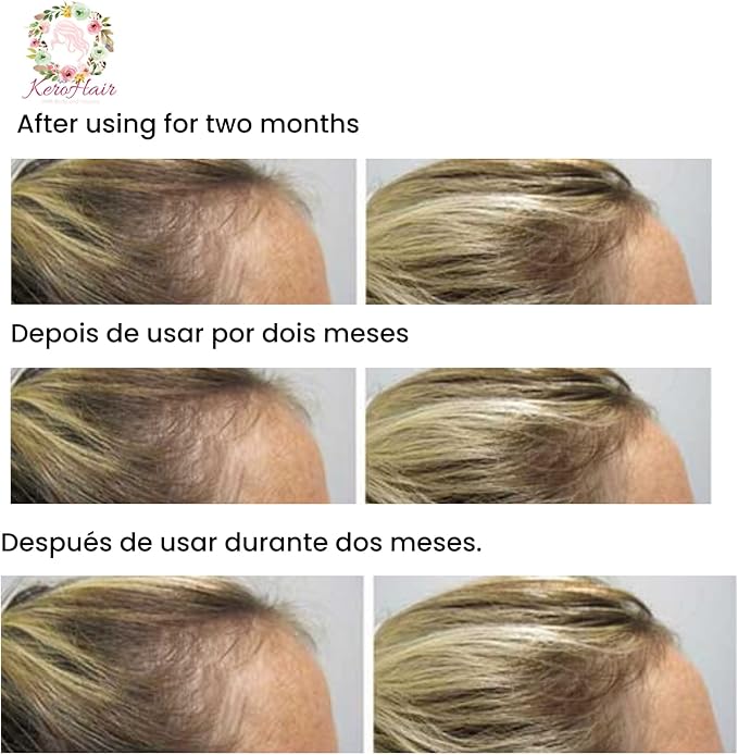 KeroHair Complete Supplement with Vitamins and Biotin I 60 Capsules for Strong and Healthy Hair Growth - Prevents Hair Loss | Approved* Enriched with Extra Biotin and Vitamin B