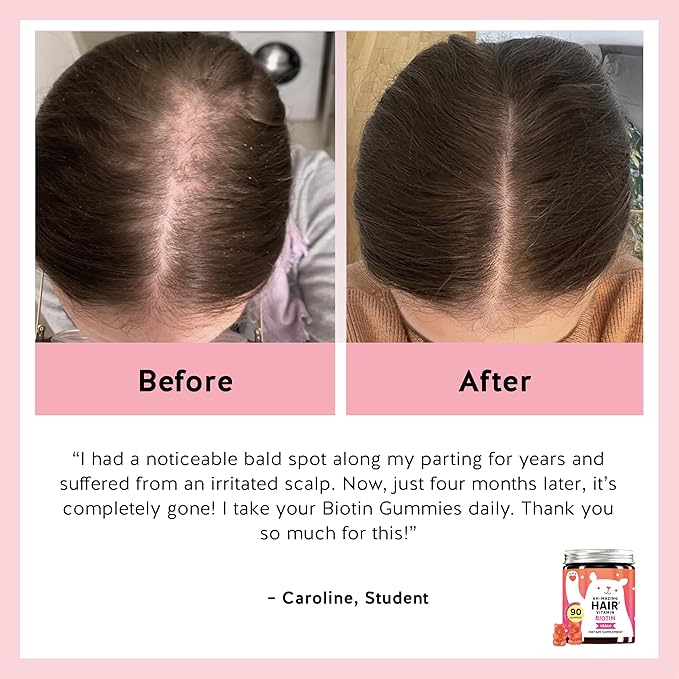 Biotin Gummies for Hair, Skin & Nails. 5,000 mcg High Potency Vegan Vitamins for Faster Hair Growth, Stronger Nails & Healthy Skin. with Vitamins C & E, 60 Gummies